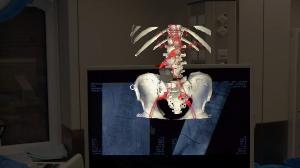 Obraz hologramu widziany przez gogle Hololens, fot. USK-2